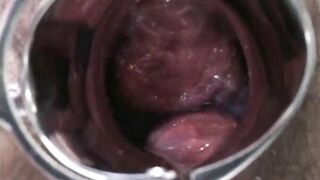 Hot Preggy Sexy Girl with male nurses & doc love to suck cocks.